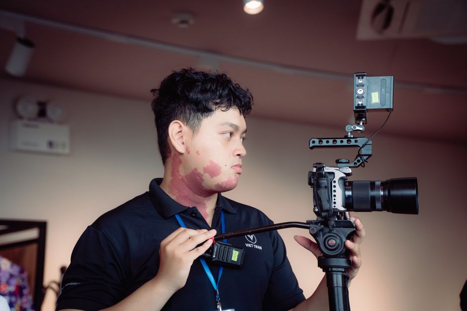 Young photographer with a birthmark operating a professional camera indoors.